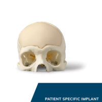 CRANOS, räätälöidyt implantit kallon rekonstruktioon